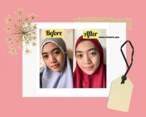 hasil menggunakan facial wash dan juga serum selama satu minggu